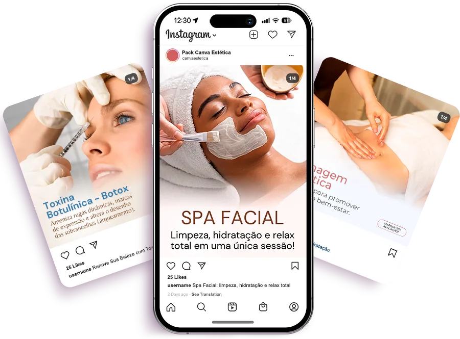 Exemplos de posts do Ultra Pack Canva Esteticista